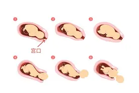 “开十指”才能顺产？带你了解开宫口的过程图片