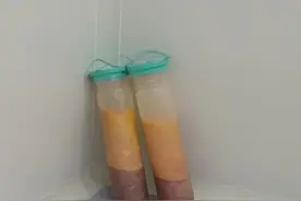 网红吸脂感染去世，专家告诉你关于吸脂的真相图片