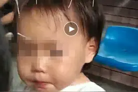 女婴注射疫苗导致脑瘫，三级诊断证实属接种异常反应，卫健局：医疗生活救助从未中断，接种异常不代表有过失图片