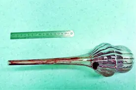 河北10岁男孩摔倒，玻璃花瓶从臀部插入体内！这些事你一定要知道图片