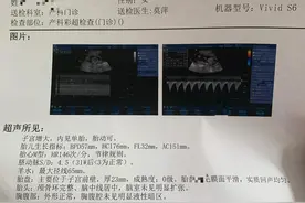 怀孕五个月、能看出男孩女孩吗？图片