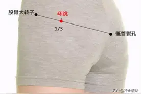 治疗一切下肢疾病的要穴——环跳穴图片