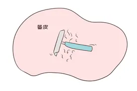 生孩子遇上男护士“备皮”，产妇什么感受？过来人：恨不得钻地图片