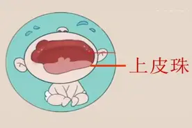 新生儿自带“牙齿”出生，宝妈喂奶被咬疼，医生：属“诞生牙”图片
