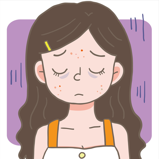 鐢ㄤ粈涔堟礂闈㈠ザ鑳芥帶娌圭鐥橈紵涓嶅Θ璇曡瘯杩欐姘ㄥ熀閰告磥闈㈡厱鏂? onerror=