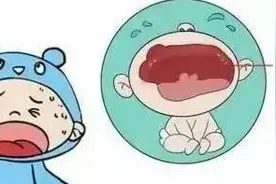 发现新生儿宝宝小腿是弧形的？正常！细数新生儿几个正常现象图片