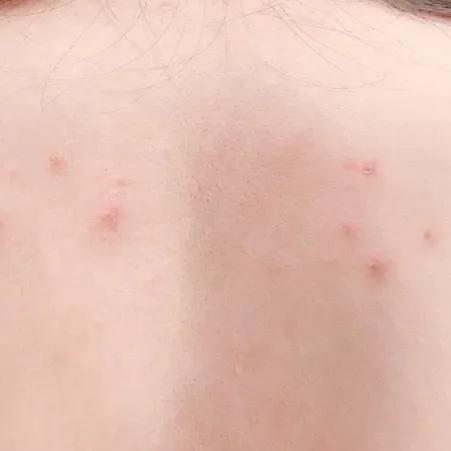 野脚鸡皮肤穿裙子 野脚鸡皮肤穿裙子