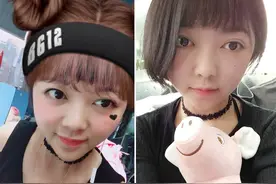 24岁美女因重度营养不良进ICU，瘦到只有50斤，几乎只剩一把骨头图片