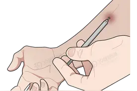 如何分辨一个人是否吸毒？看完这些吸毒者的典型症状，心里发毛图片