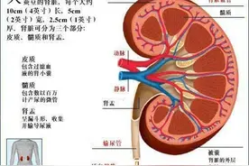 肾病综合征图片