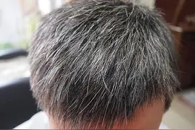 白发越多越显老，平时注意这4点，不染发头发也能乌黑亮丽图片