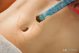问答针灸——选择针灸，需要注意的问题图片