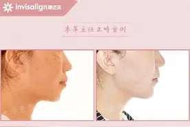 太原牙齿矫正：优先拔除坏牙，前移智齿图片