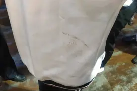 因未给车让路，西安16岁女生遭年轻男女殴打住院，目击者：前胸后背都是脚印图片