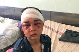 俄17岁男孩与前女友约会，被她男友发现用铲柄奸虐，致严重内出血图片