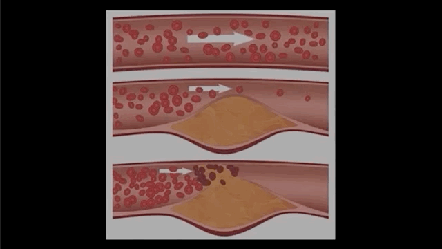 糖：最甜蜜的杀手，成瘾性极强？我们为什么无法戒糖…