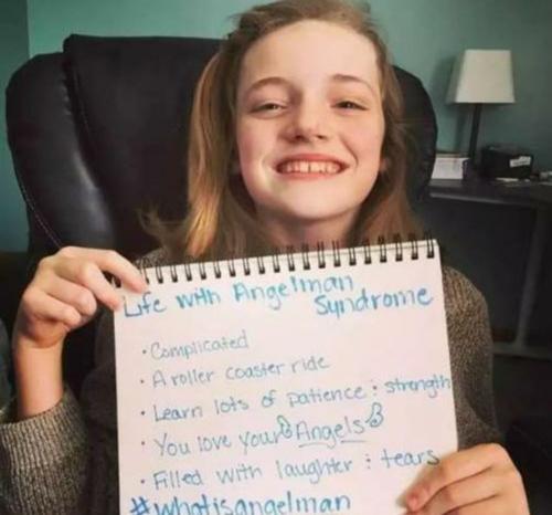 罕见病丨爱笑的"折翼"天使——天使综合征(快乐木偶综合症图片怎么