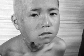 日本核爆炸时，毫无知觉便死亡了吗？科学表明被炸死的人有多痛苦图片
