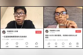 34岁“抗癌网红”去世，一年时间从帅哥变成老人，一张图刺痛全网……图片