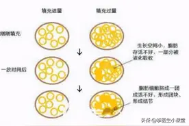 肛门周围总是潮湿瘙痒，是什么疾病？医生告诉你应该怎么治疗？图片
