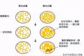 肛门周围总是潮湿瘙痒，是什么疾病？医生告诉你应该怎么治疗？图片