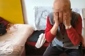 男子常年不洗脸！却不是因为懒，而是因为病图片