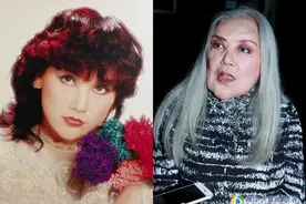 明知整容医美是“火坑”，为何女明星们还要“争先恐后”往里跳？图片