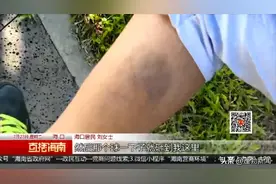 一女子路过公园被篮球砸伤 健身设施投放不应忽视安全图片