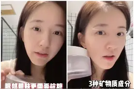 “笑眼甜心”赵露思自曝眼部神器，用30天就像做了一次热玛吉？图片