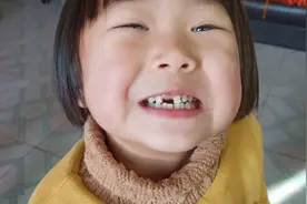 5岁孩子蛀牙率达66%：孩子的牙，到底该咋刷？图片