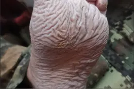 救灾武警战士脚丫被泡起皱让人心疼，但无需担心是泡坏了图片