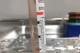 恐怖！22岁女老师每天一杯奶茶，午休时突然晕倒小便失禁，连血都是乳白色图片