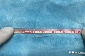 大头针般鱼刺，卡进6个月宝宝喉咙！孩子加辅食，宝妈漏了一步，险酿大错图片
