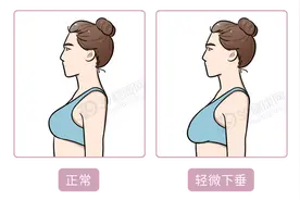 女人岁数上来后，开始胸下垂、松弛？先别瞎折腾，试试这3个动作图片