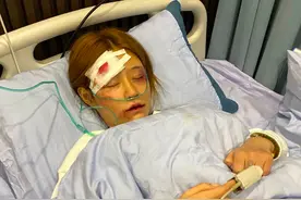 假的？戏精？百万网红王多鱼遭男友家暴住院，满身伤痕被质疑演戏图片