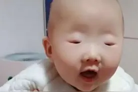 全网眼睛最小宝宝火了，李荣浩都要甘拜下风，网友：芝麻吃多了？图片