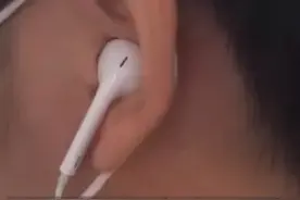 14岁女生常戴耳机听歌，致噪音性耳聋！医生：已错过最佳治疗时期图片