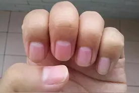 指甲上的“月牙”越多越健康？真的是这样吗？一次性说清楚！图片