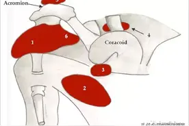 肩关节周围滑囊解剖图片