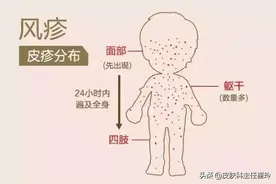 注意了，这些皮肤病是可以传染的图片