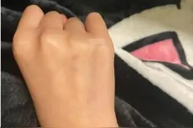 广州两人称在天河被人扎针引发恐慌，被扎为何须马上去医院阻断？图片