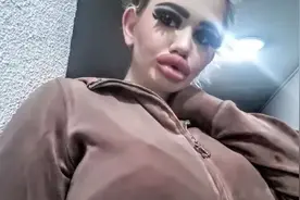 20次丰唇手术，她把自己整成了“世界上嘴唇最厚”的真人芭比图片