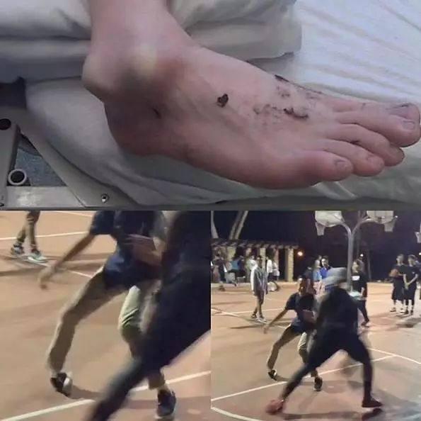 美国十大街球传奇：骨头收集者把人脚踝晃变形，这哥们真进了医院