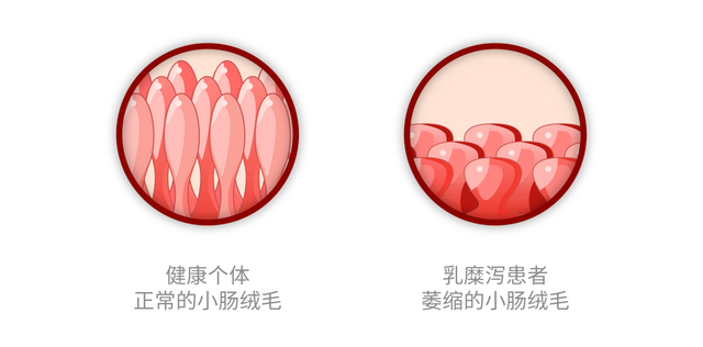 说自己麸质不耐受的人，真的了解麸质嘛？