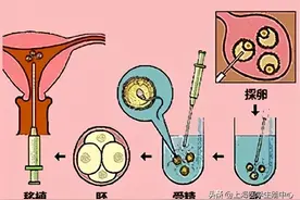 试管婴儿真的适合所有人吗？图片
