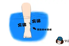 军医小茵丨警惕水中的“隐藏杀手”，这份防治血吸虫宝典请收好图片