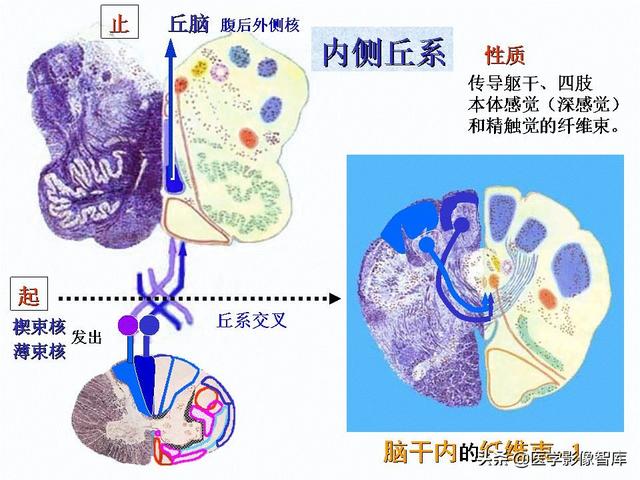 脑干、小脑及间脑解剖