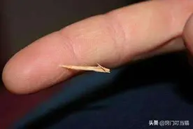 “木刺”扎进手里别用针挑！教你简单一招，让木刺“自动”跑出来图片