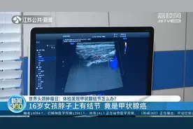 16岁女孩脖子上有结节 竟是甲状腺癌图片