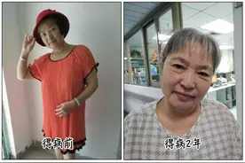 63岁阿姨全身骨痛，3年找不到原因，髋关节一换就好了！图片